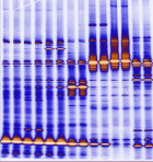 Researchers identify protein that counteracts key rattlesnake venom toxins