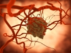 Oxford cancer blood test detects tumors and metastasis early