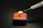 Tiny dental nanobots generate heat to deep clean the teeth