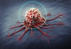 mRNA skin cancer therapy halves risk of death in clinical trial
