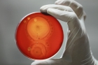 Grow a pair: Lab-grown testicles tackle infertility treatment